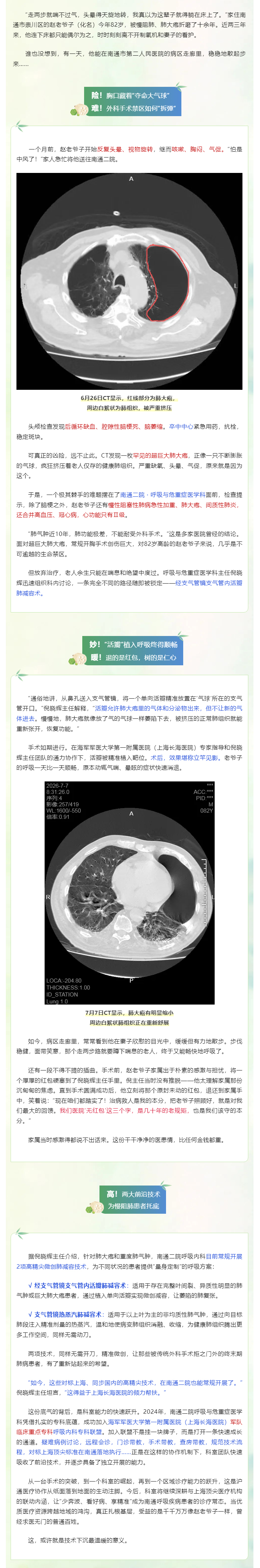 【医技新势力】罕见巨大肺大疱+慢阻肺，南通二院说不开刀，咱来给肺“减减肥”.jpg